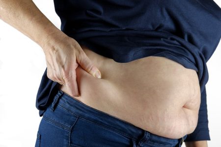How To Get Rid Of Apron Belly Without Surgery