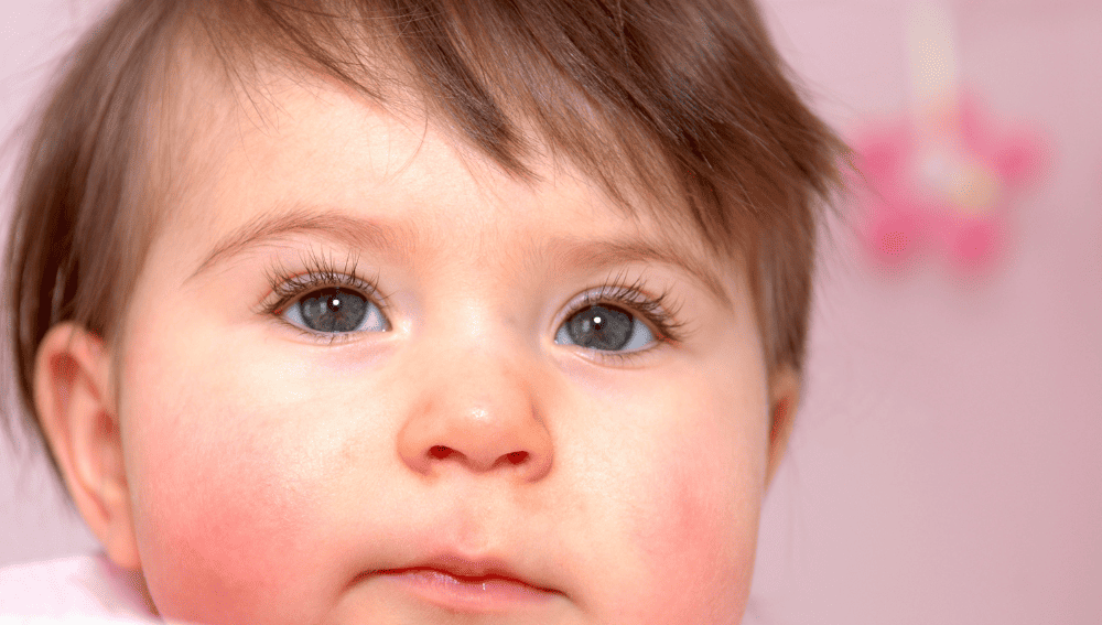Common Eyelash Concerns in Babies