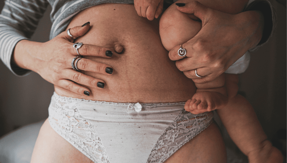 Understanding Postpartum Belly