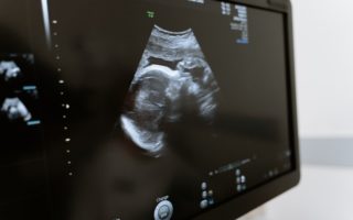 How to Read Ultrasound Numbers