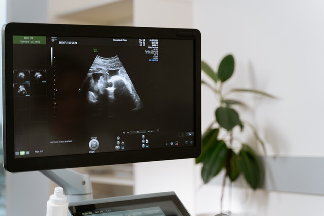 Baby's Face Looks Weird On Ultrasound