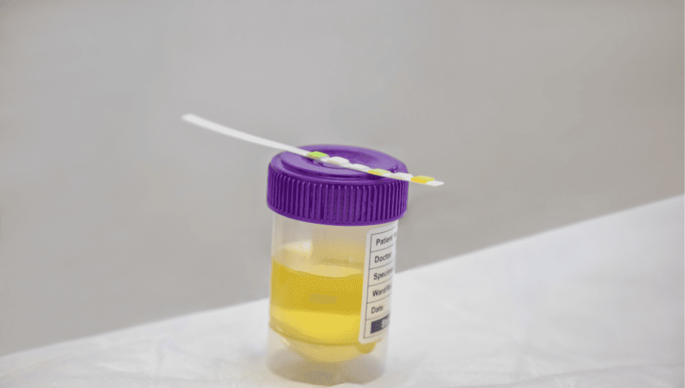 Understanding Urine Color