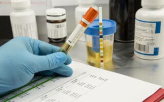 Do OB/GYNs Drug Test During Pregnancy