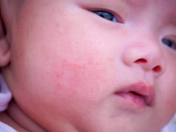 How to Stop Baby Scratching Face at Night