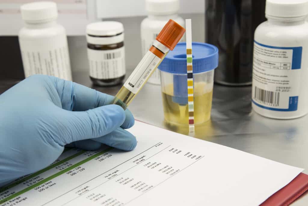Procedure and Accuracy of Urine Drug Test