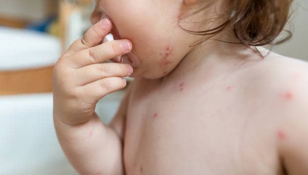 How to Stop Baby Scratching Face at Night