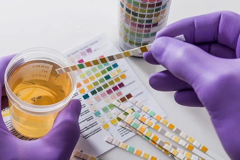 Understanding Urine Drug Testing