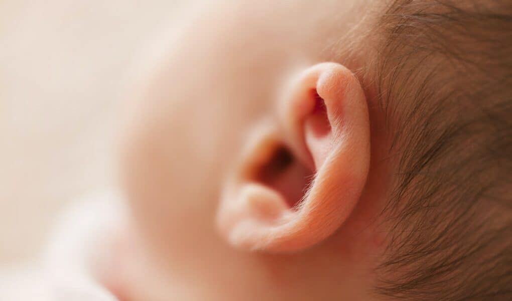 Newborn Ear Color Determine Skin Color